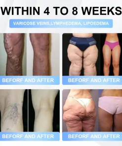 LBMLBM® Tirzepatide Slimming & Health Nano Microneedle Patch