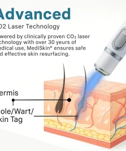 MediSkin Laser