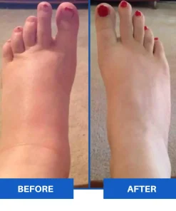 Medinity™ Advanced EMS Foot Massager