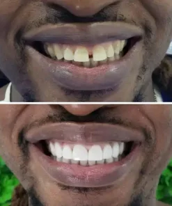 Misspone® Essential Care Toothpaste – 6 - in - 1 Whitening + Total Care