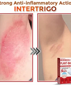 Newyuo® MicroNeedle Botanic Skin Tag Removal Patch