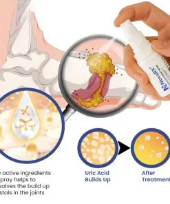 NovaRX® GoutEase Relief Spray