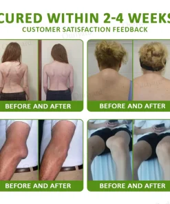 NovaRX® Magnesium & Peppermint Arthritis Pain Relief and Bone Healing Cream