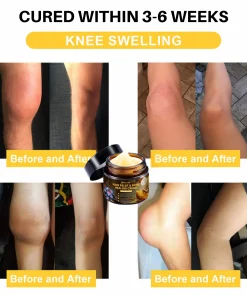 NovaRX® Pain Relief & Bone Healing Cream with Bee Venom