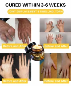 NovaRX® Pain Relief & Bone Healing Cream with Bee Venom