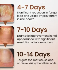 Piguiay® Nails Repairing Serum