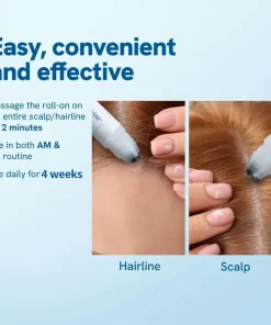 Slimoly™ Professional Anti-Hair Loss Roll-On – Stimulates Hair Growth in 1–2 Weeks