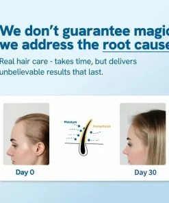 Slimoly™ Professional Anti-Hair Loss Roll-On – Stimulates Hair Growth in 1–2 Weeks