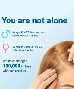 Slimoly™ Professional Anti-Hair Loss Roll-On – Stimulates Hair Growth in 1–2 Weeks