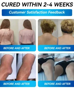 𝐵𝑜𝑠𝑡𝑜𝑟𝑒® 𝐵𝑃𝐶-157 𝐽𝑜𝑖𝑛𝑡 𝑅𝑒𝑠𝑡𝑜𝑟𝑒 𝑂𝑟𝑎𝑙 𝐿𝑖𝑞𝑢𝑖𝑑