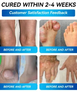 𝐵𝑜𝑠𝑡𝑜𝑟𝑒® 𝐵𝑃𝐶-157 𝐽𝑜𝑖𝑛𝑡 𝑅𝑒𝑠𝑡𝑜𝑟𝑒 𝑂𝑟𝑎𝑙 𝐿𝑖𝑞𝑢𝑖𝑑