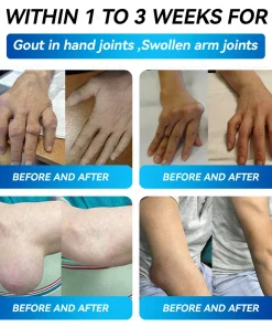 𝐵𝑜𝑠𝑡𝑜𝑟𝑒® 𝐵𝑃𝐶-157 𝐽𝑜𝑖𝑛𝑡 𝑅𝑒𝑠𝑡𝑜𝑟𝑒 𝑂𝑟𝑎𝑙 𝐿𝑖𝑞𝑢𝑖𝑑