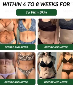 𝑲𝒆𝒚𝒆𝒔𝒔®𝑮𝑳𝑷-1 9-𝒊𝒏-1 𝑯𝒆𝒂𝒍𝒕𝒉 𝑶𝒓𝒂𝒍 𝑳𝒊𝒒𝒖𝒊𝒅 — 𝑰𝒎𝒎𝒖𝒏𝒆 & 𝑫𝒆𝒕𝒐𝒙 𝑺𝒖𝒑𝒑𝒐𝒓𝒕 𝑭𝒐𝒓𝒎𝒖𝒍𝒂