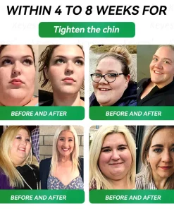 𝑲𝒆𝒚𝒆𝒔𝒔®𝑮𝑳𝑷-1 9-𝒊𝒏-1 𝑯𝒆𝒂𝒍𝒕𝒉 𝑶𝒓𝒂𝒍 𝑳𝒊𝒒𝒖𝒊𝒅 — 𝑰𝒎𝒎𝒖𝒏𝒆 & 𝑫𝒆𝒕𝒐𝒙 𝑺𝒖𝒑𝒑𝒐𝒓𝒕 𝑭𝒐𝒓𝒎𝒖𝒍𝒂