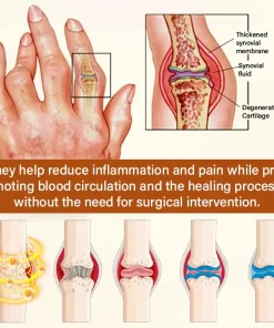 Blizkox® VenomEase Joint Cream