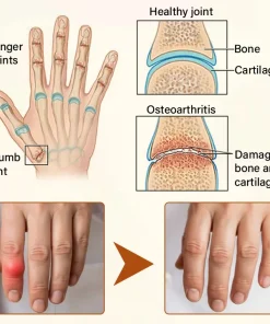 Blizkox® VenomEase Joint Cream