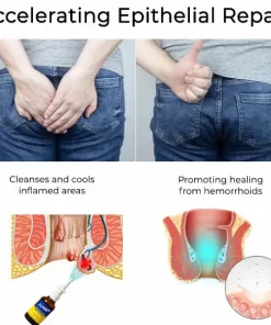 Juxek® Herbal Hemorrhoid Treatment Anal Spray Pro