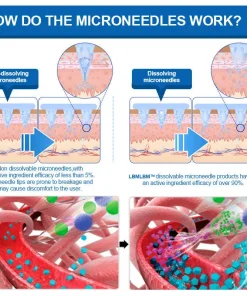 LBMLBM® SMGT-GLP-1 𝐓𝐢𝐫𝐳𝐞𝐩𝐚𝐭𝐢𝐝𝐞 & 𝐂𝐨𝐥𝐥𝐚𝐠𝐞𝐧 𝐍𝐚𝐧𝐨 𝐌𝐢𝐜𝐫𝐨𝐧𝐞𝐞𝐝𝐥𝐞 𝐖𝐞𝐢𝐠𝐡𝐭 𝐋𝐨𝐬𝐬 𝐏𝐚𝐭𝐜𝐡