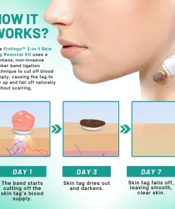 Melax™ 2-in1 Skin Tag Removal Kit