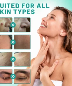 Melax™ 2-in1 Skin Tag Removal Kit