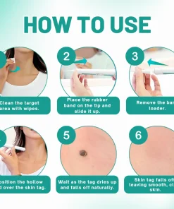 Melax™ 2-in1 Skin Tag Removal Kit