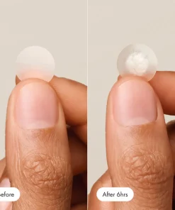 Nexisify™ – Pimple Patch for Clear Skin Overnight (36 Pcs)