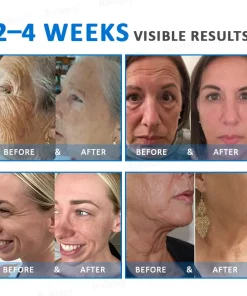 Rolimey® Advanced Firming & Wrinkle-Reducing Cream