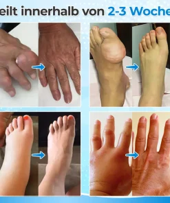 Seurico™ EnduraHeal Magnesium Pain Relief Cream