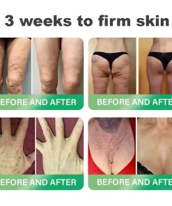 𝐇𝐨𝐧𝐱𝐢® 𝐍𝐀𝐃+ 𝐆𝐋𝐏-𝟏 𝐒𝐢𝐱 𝐢𝐧 𝐎𝐧𝐞 𝐇𝐞𝐚𝐥𝐭𝐡 𝐒𝐨𝐥𝐮𝐭𝐢𝐨𝐧 𝐎𝐫𝐚𝐥 𝐋𝐢𝐪𝐮𝐢𝐝