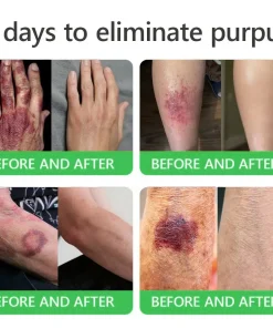 𝐎𝐫𝐢𝐚𝐜𝐡® 𝐀𝟏𝟎+ 𝟔-𝐢𝐧-𝟏 𝐃𝐞𝐫𝐦𝐚𝐑𝐞𝐩𝐚𝐢𝐫 𝐒𝐞𝐫𝐮𝐦