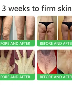 𝐎𝐫𝐢𝐚𝐜𝐡® 𝐀𝟏𝟎+ 𝟔-𝐢𝐧-𝟏 𝐃𝐞𝐫𝐦𝐚𝐑𝐞𝐩𝐚𝐢𝐫 𝐒𝐞𝐫𝐮𝐦