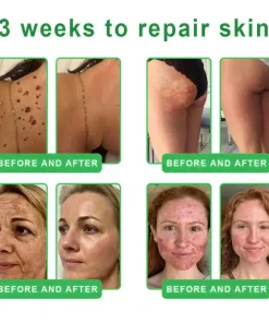 𝐎𝐫𝐢𝐚𝐜𝐡® 𝐀𝟏𝟎+ 𝟔-𝐢𝐧-𝟏 𝐃𝐞𝐫𝐦𝐚𝐑𝐞𝐩𝐚𝐢𝐫 𝐒𝐞𝐫𝐮𝐦