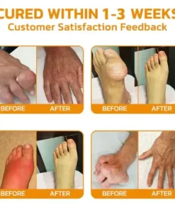 𝐌𝐚𝐠𝐧𝐞𝐬𝐢𝐮𝐦 & 𝐁𝐞𝐞 𝐕𝐞𝐧𝐨𝐦 𝐏𝐚𝐢𝐧—𝐑𝐞𝐥𝐢𝐞𝐟 𝐁𝐨𝐧𝐞 𝐇𝐞𝐚𝐥𝐢𝐧𝐠 𝐂𝐫𝐞𝐚𝐦