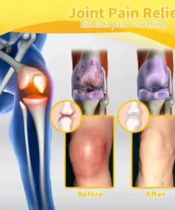 𝐌𝐚𝐠𝐧𝐞𝐬𝐢𝐮𝐦 & 𝐁𝐞𝐞 𝐕𝐞𝐧𝐨𝐦 𝐏𝐚𝐢𝐧—𝐑𝐞𝐥𝐢𝐞𝐟 𝐁𝐨𝐧𝐞 𝐇𝐞𝐚𝐥𝐢𝐧𝐠 𝐂𝐫𝐞𝐚𝐦