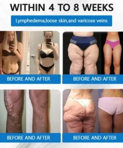 𝐓𝐢𝐫𝐳𝐞𝐩𝐚𝐭𝐢𝐝𝐞 & 𝐂𝐨𝐥𝐥𝐚𝐠𝐞𝐧 𝐍𝐚𝐧𝐨 𝐌𝐢𝐜𝐫𝐨𝐧𝐞𝐞𝐝𝐥𝐞 𝐖𝐞𝐢𝐠𝐡𝐭 𝐋𝐨𝐬𝐬 𝐏𝐚𝐭𝐜𝐡