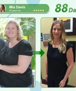 𝑵𝒂𝒏𝒐 𝑴𝒊𝒄𝒓𝒐𝒏𝒆𝒆𝒅𝒍𝒆 𝑷𝒂𝒕𝒄𝒉 𝒘𝒊𝒕𝒉 𝑺𝑴𝑮𝑻-𝑮𝑳𝑷-1 & 𝑴𝒂𝒕𝒓𝒊𝒙𝒚𝒍 3000