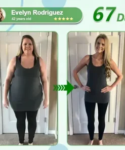 𝑵𝒂𝒏𝒐 𝑴𝒊𝒄𝒓𝒐𝒏𝒆𝒆𝒅𝒍𝒆 𝑷𝒂𝒕𝒄𝒉 𝒘𝒊𝒕𝒉 𝑺𝑴𝑮𝑻-𝑮𝑳𝑷-1 & 𝑴𝒂𝒕𝒓𝒊𝒙𝒚𝒍 3000