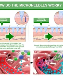 𝑵𝒂𝒏𝒐 𝑴𝒊𝒄𝒓𝒐𝒏𝒆𝒆𝒅𝒍𝒆 𝑷𝒂𝒕𝒄𝒉 𝒘𝒊𝒕𝒉 𝑺𝑴𝑮𝑻-𝑮𝑳𝑷-1 & 𝑴𝒂𝒕𝒓𝒊𝒙𝒚𝒍 3000