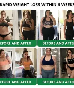 𝑵𝒂𝒏𝒐 𝑴𝒊𝒄𝒓𝒐𝒏𝒆𝒆𝒅𝒍𝒆 𝑷𝒂𝒕𝒄𝒉 𝒘𝒊𝒕𝒉 𝑺𝑴𝑮𝑻-𝑮𝑳𝑷-1 & 𝑴𝒂𝒕𝒓𝒊𝒙𝒚𝒍 3000