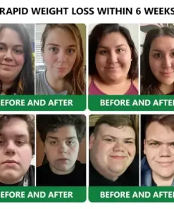 𝑵𝒂𝒏𝒐 𝑴𝒊𝒄𝒓𝒐𝒏𝒆𝒆𝒅𝒍𝒆 𝑷𝒂𝒕𝒄𝒉 𝒘𝒊𝒕𝒉 𝑺𝑴𝑮𝑻-𝑮𝑳𝑷-1 & 𝑴𝒂𝒕𝒓𝒊𝒙𝒚𝒍 3000