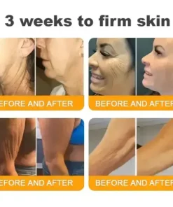 𝐁𝒆𝒆 𝐕𝒆𝐧𝐨𝐦 𝐂𝐨𝐦𝐩𝐫𝒆𝐡𝐞𝐧𝐬𝐢𝐯𝐞 𝐒𝐤𝐢𝐧 𝐑𝒆𝐬𝐭𝐨𝐫𝐚𝐭𝐢𝐨𝐧 𝐂𝐫𝒆𝐚𝐦