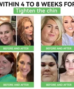 𝐁𝐞𝐫𝒃𝒆𝒓𝒊𝒏𝒆 𝑾𝒆𝒊𝒈𝒉𝒕 𝑳𝒐𝒔𝒔 𝑶𝒓𝒂𝒍 𝑺𝒐𝒍𝒖𝒕𝒊𝒐𝒏