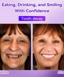 𝑇𝑒𝑒𝑡ℎ 𝑅𝑒𝑠𝑡𝑜𝑟𝑎𝑡𝑖𝑜𝑛 𝑀𝑖𝑛𝑒𝑟𝑎𝑙 𝑃𝑜𝑤𝑑𝑒𝑟