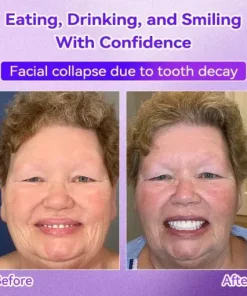 𝑇𝑒𝑒𝑡ℎ 𝑅𝑒𝑠𝑡𝑜𝑟𝑎𝑡𝑖𝑜𝑛 𝑀𝑖𝑛𝑒𝑟𝑎𝑙 𝑃𝑜𝑤𝑑𝑒𝑟