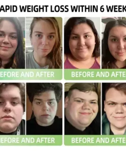 𝑵𝒂𝒏𝒐 𝑴𝒊𝒄𝒓𝒐𝒏𝒆𝒆𝒅𝒍𝒆 𝑷𝒂𝒕𝒄𝒉