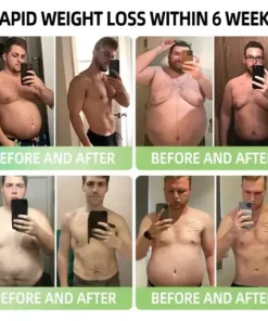 𝑵𝒂𝒏𝒐 𝑴𝒊𝒄𝒓𝒐𝒏𝒆𝒆𝒅𝒍𝒆 𝑷𝒂𝒕𝒄𝒉