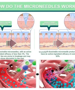 𝑆𝑤𝑖𝑓𝑡𝑠𝑎𝑟® 𝐺𝐿𝑃-1 𝑁𝑎𝑛𝑜-𝑀𝑖𝑐𝑟𝑜𝑛𝑒𝑒𝑑𝑙𝑒 𝑃𝑎𝑡𝑐ℎ