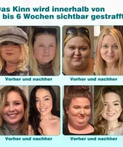 𝐌𝐢𝐤𝐫𝐨𝐧𝐚𝐝𝐞𝐥-𝐍𝐚𝐧𝐨𝐩𝐟𝐥𝐚𝐬𝐭𝐞𝐫