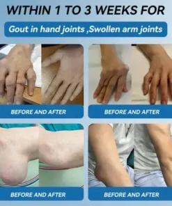 𝐉𝐨𝐢𝐧𝐭 𝐇𝐞𝐚𝐥𝐢𝐧𝐠 Capsules