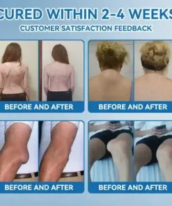 𝐉𝐨𝐢𝐧𝐭 𝐇𝐞𝐚𝐥𝐢𝐧𝐠 Capsules